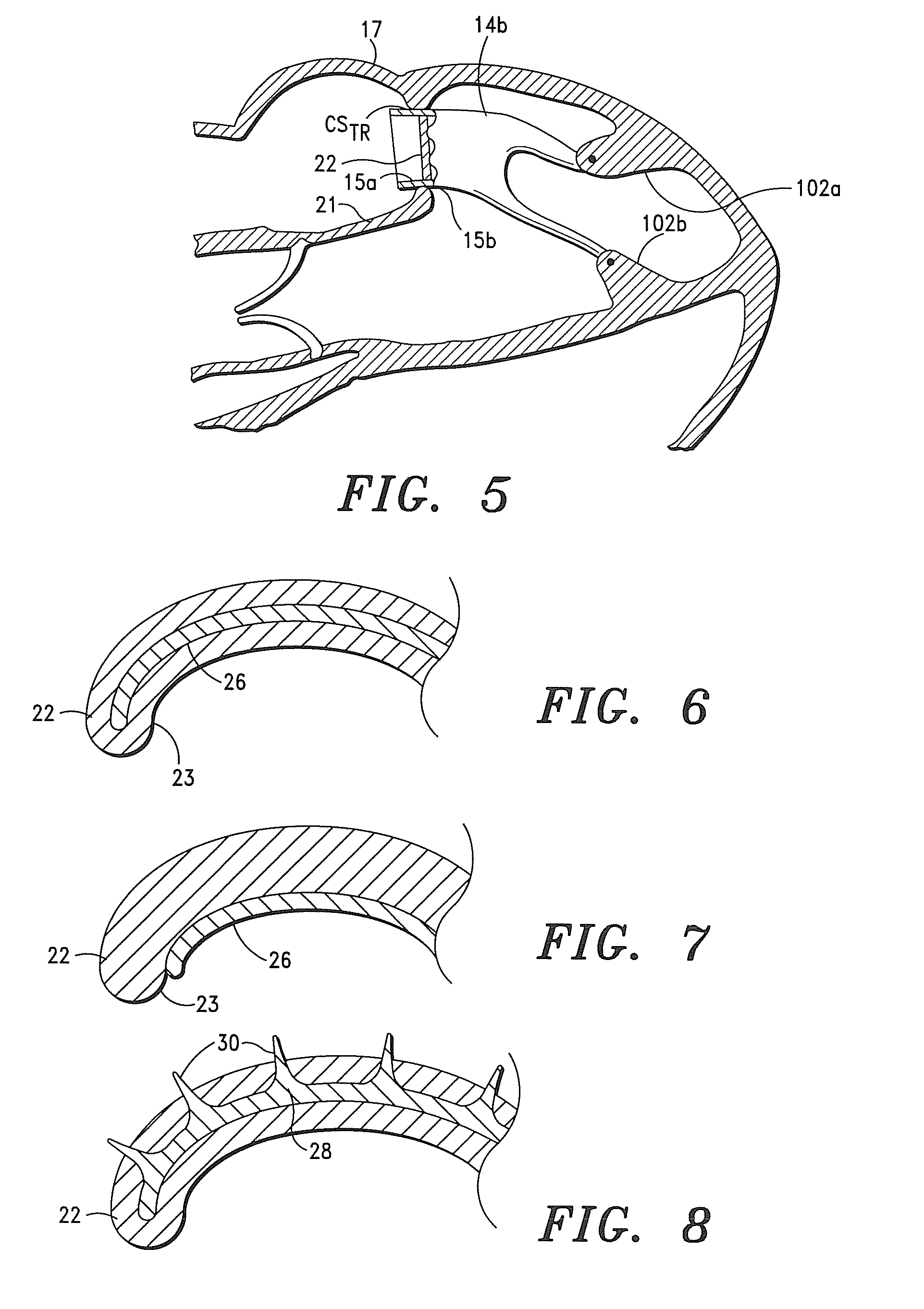 Systems, Apparatus and Methods for Sealing Perivalvular Leaks