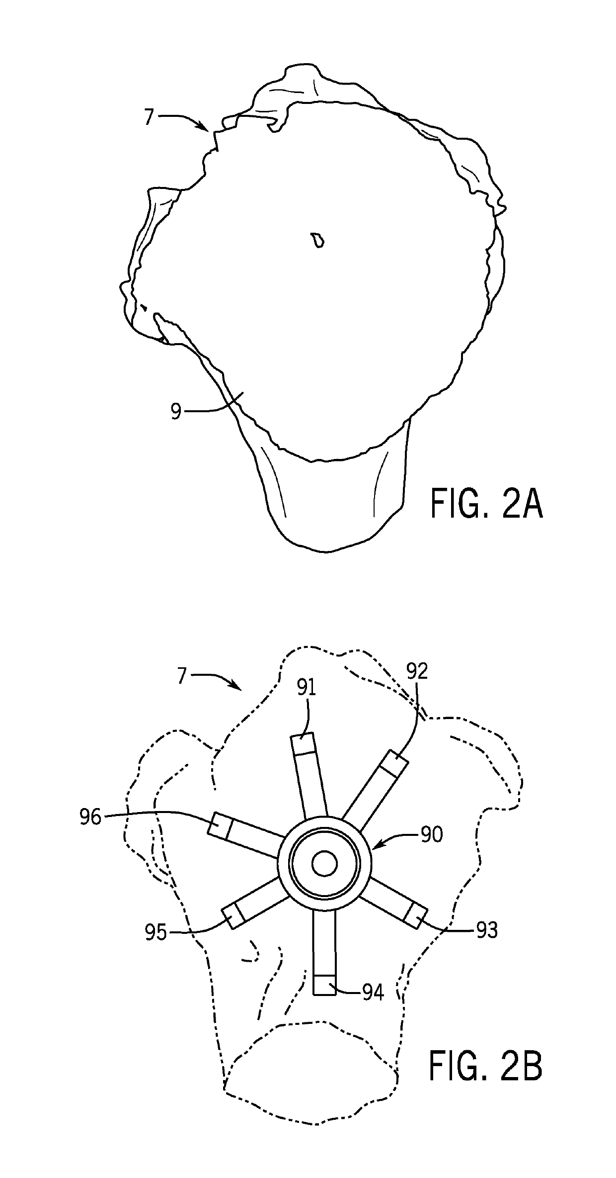 Method for Modeling Humeral Anatomy and Optimization of Component Design