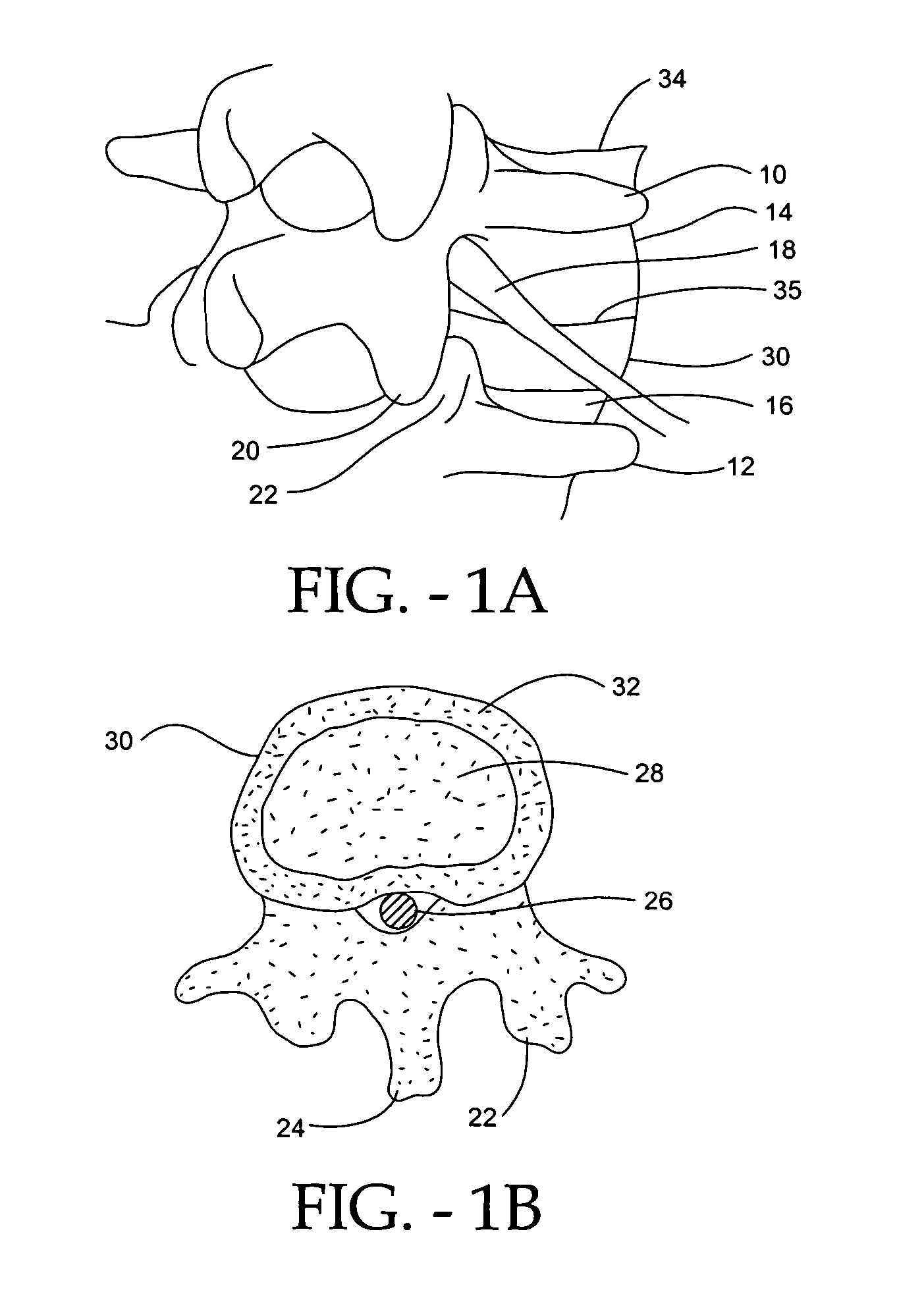 Multi-piece artificial spinal disk replacement device with selectably positioning articulating element