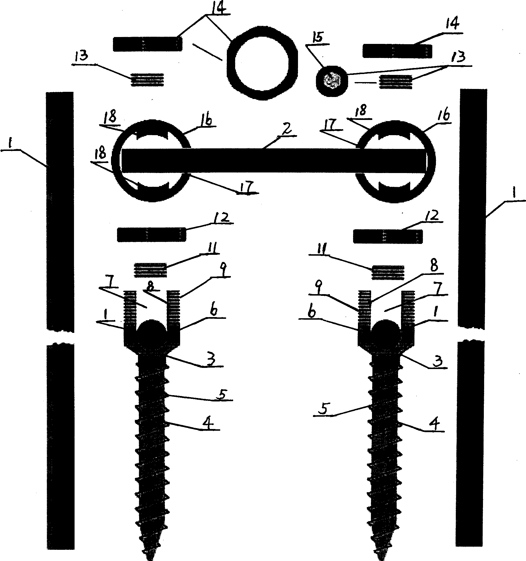 Pier bridge style screw system for vertebral arch pedicle