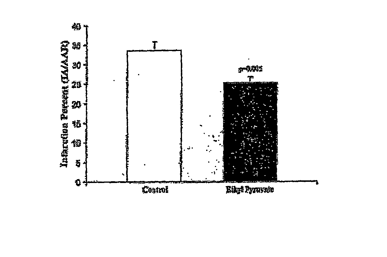 Cytoprotective Effects of Ethyl Pyruvate