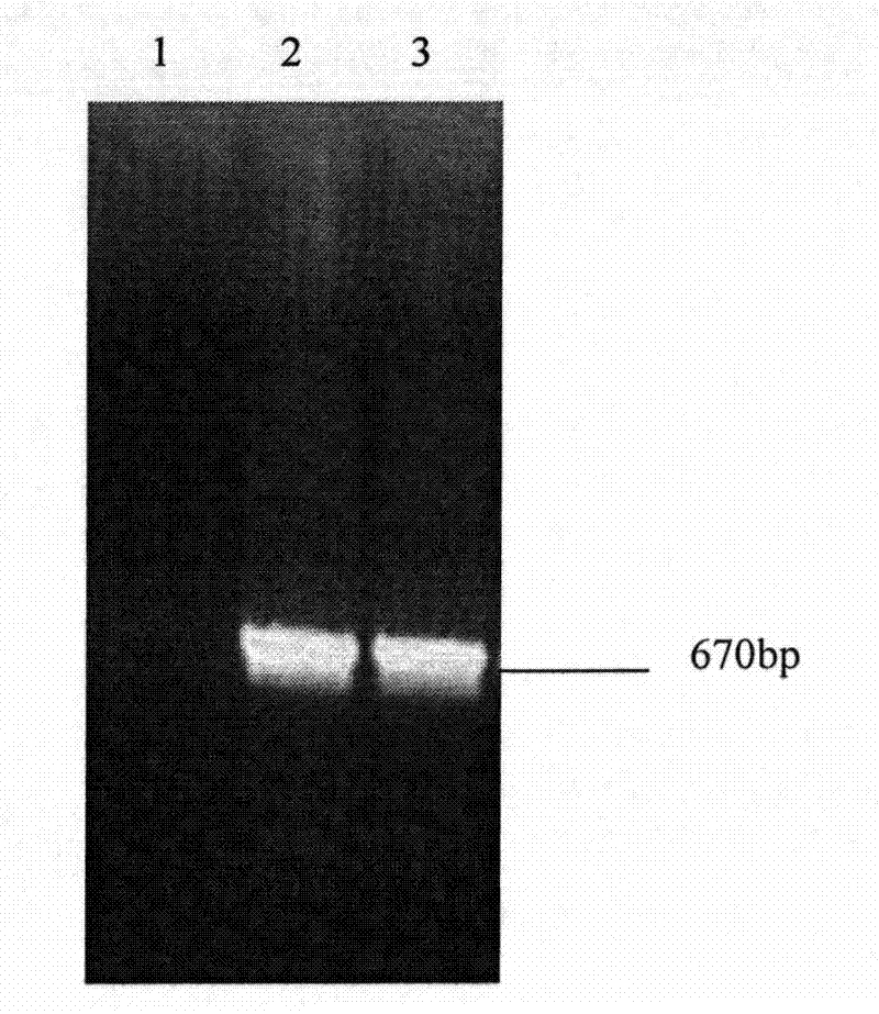 Expression of cymbidium mosaic virus coat protein gene and preparation method for antibody of cymbidium mosaic virus coat protein gene