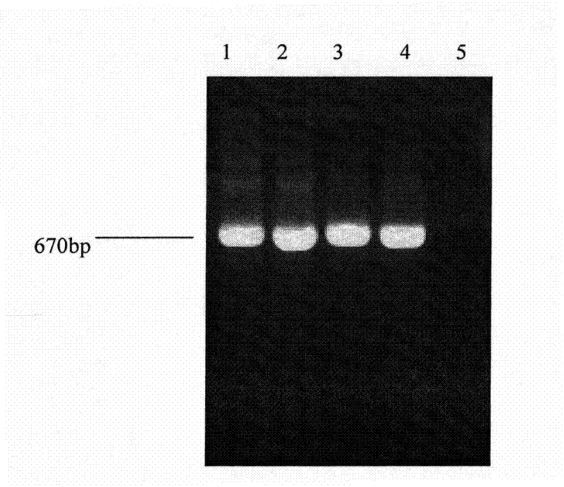 Expression of cymbidium mosaic virus coat protein gene and preparation method for antibody of cymbidium mosaic virus coat protein gene