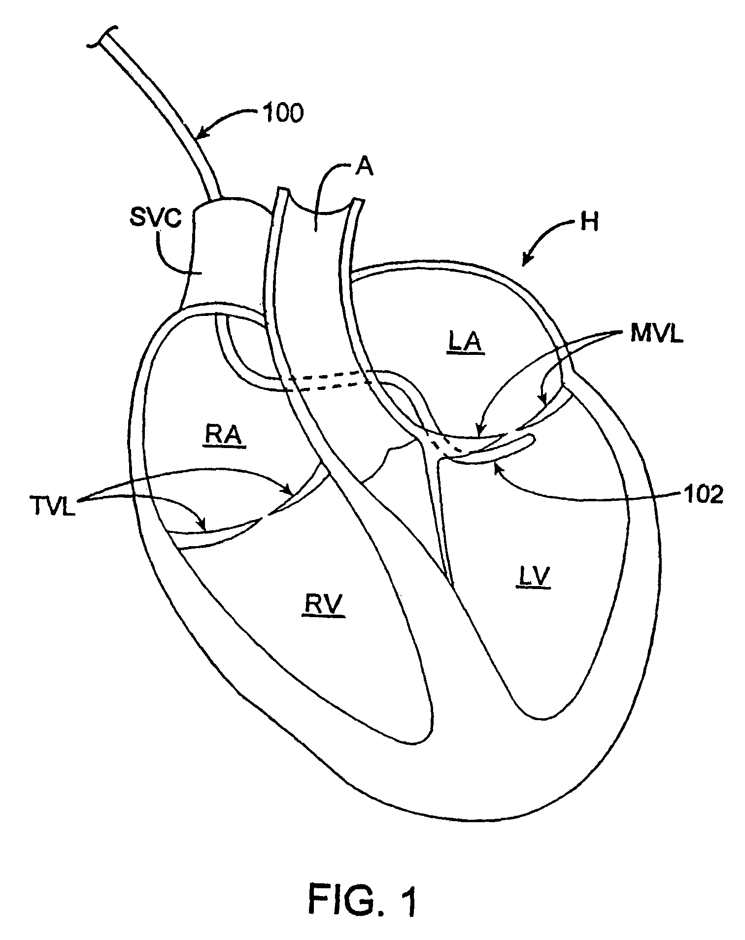 Methods and devices for termination