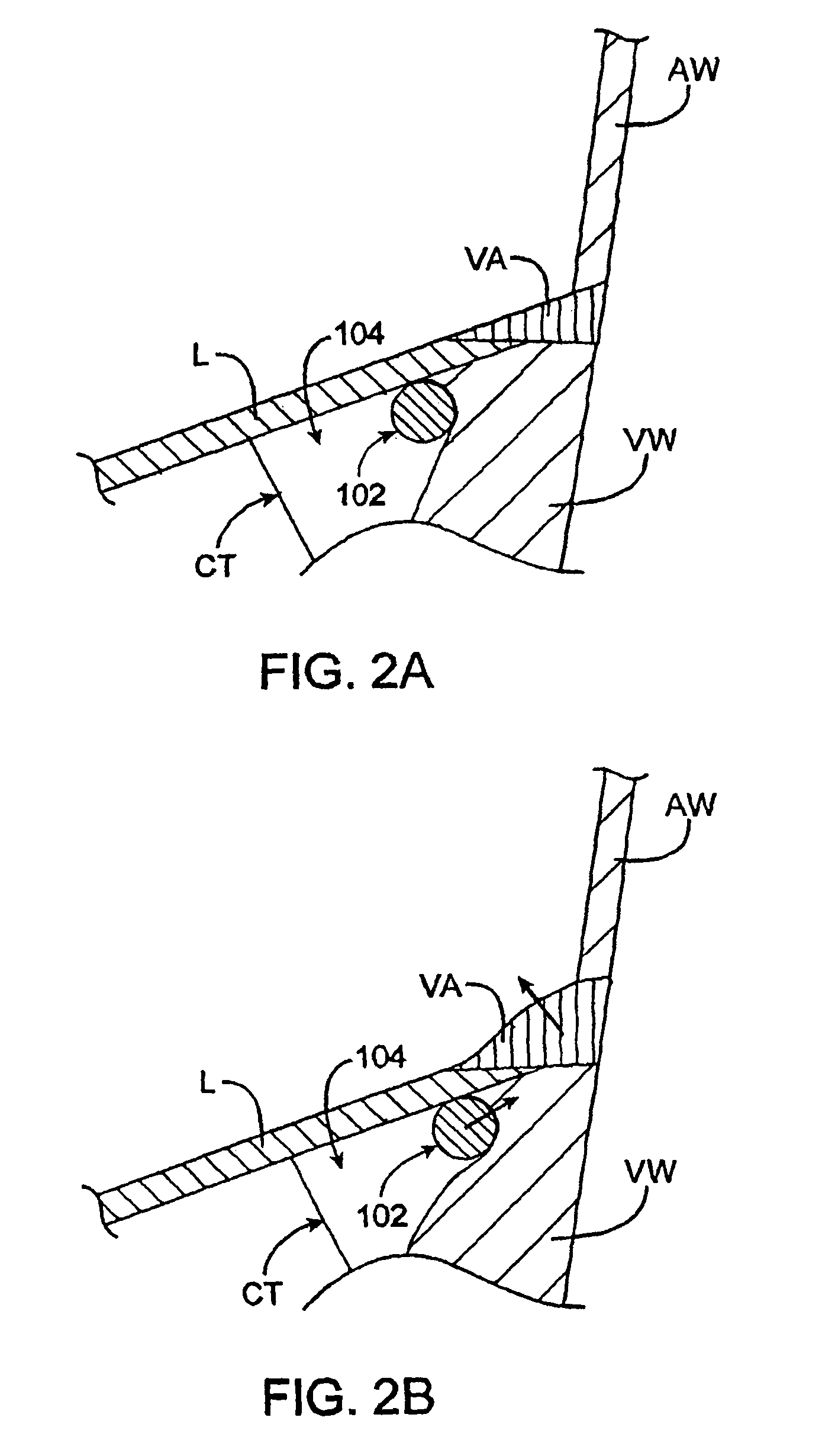 Methods and devices for termination