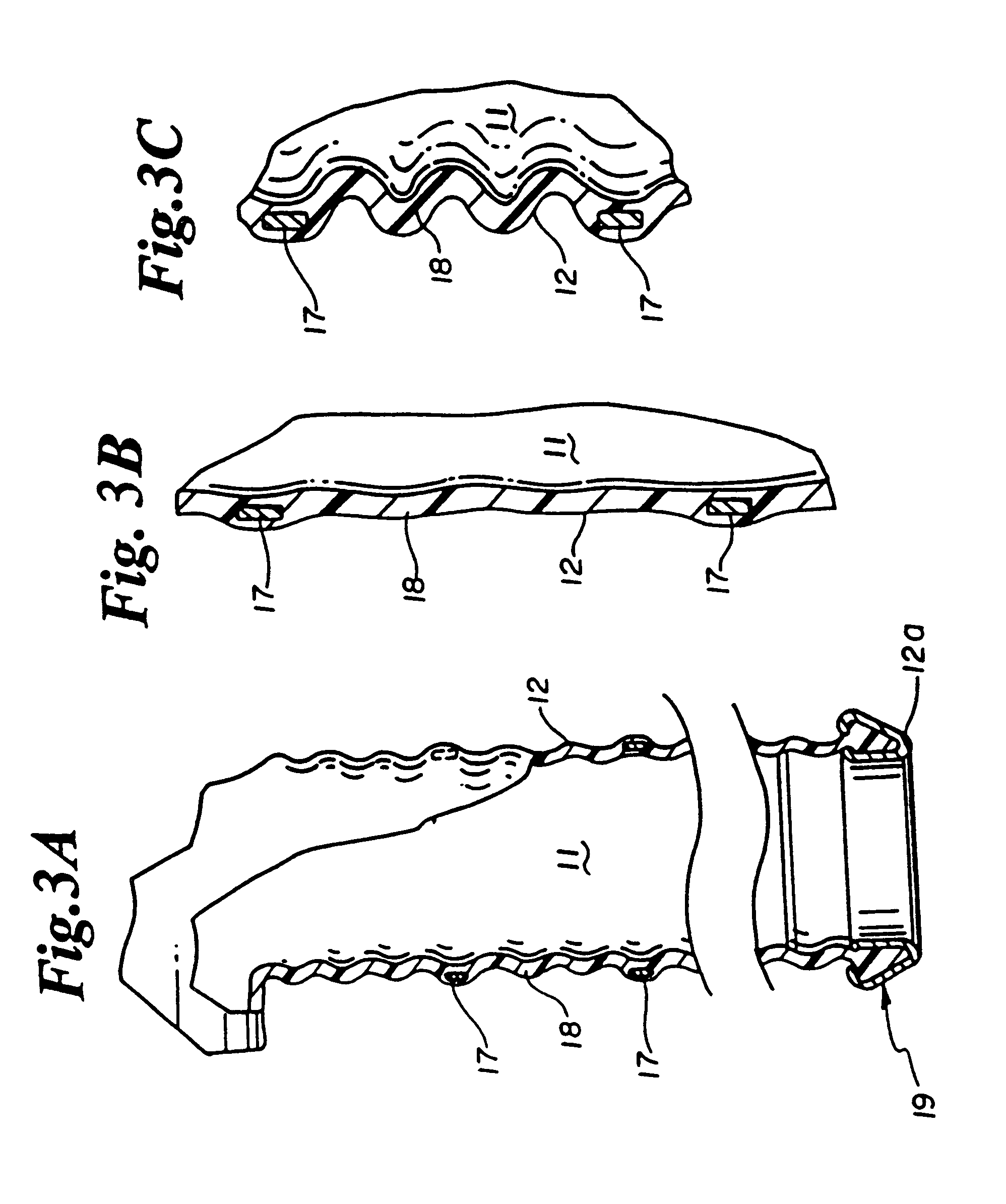 Expandable myocardial implant