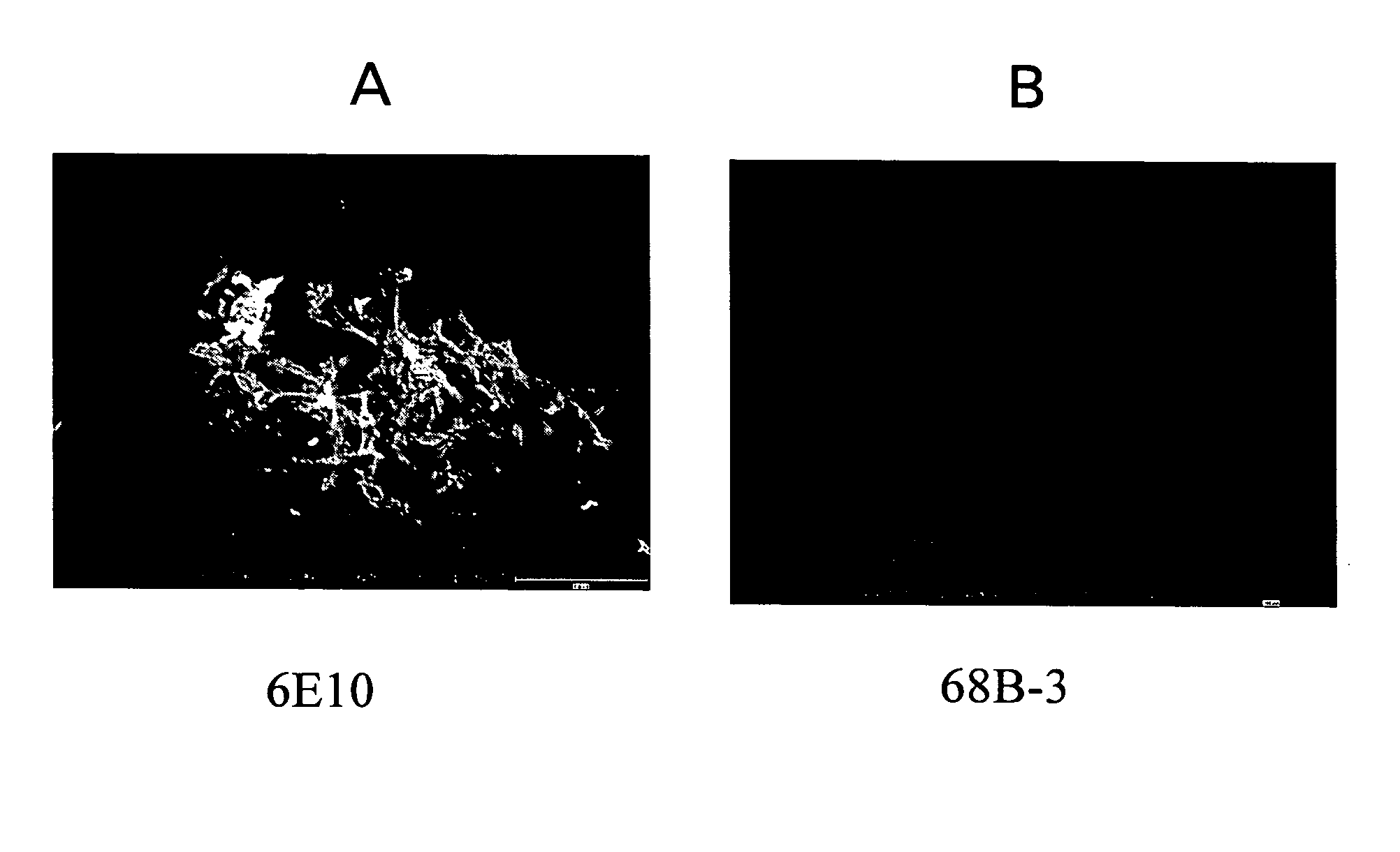 Amyloid binding assays