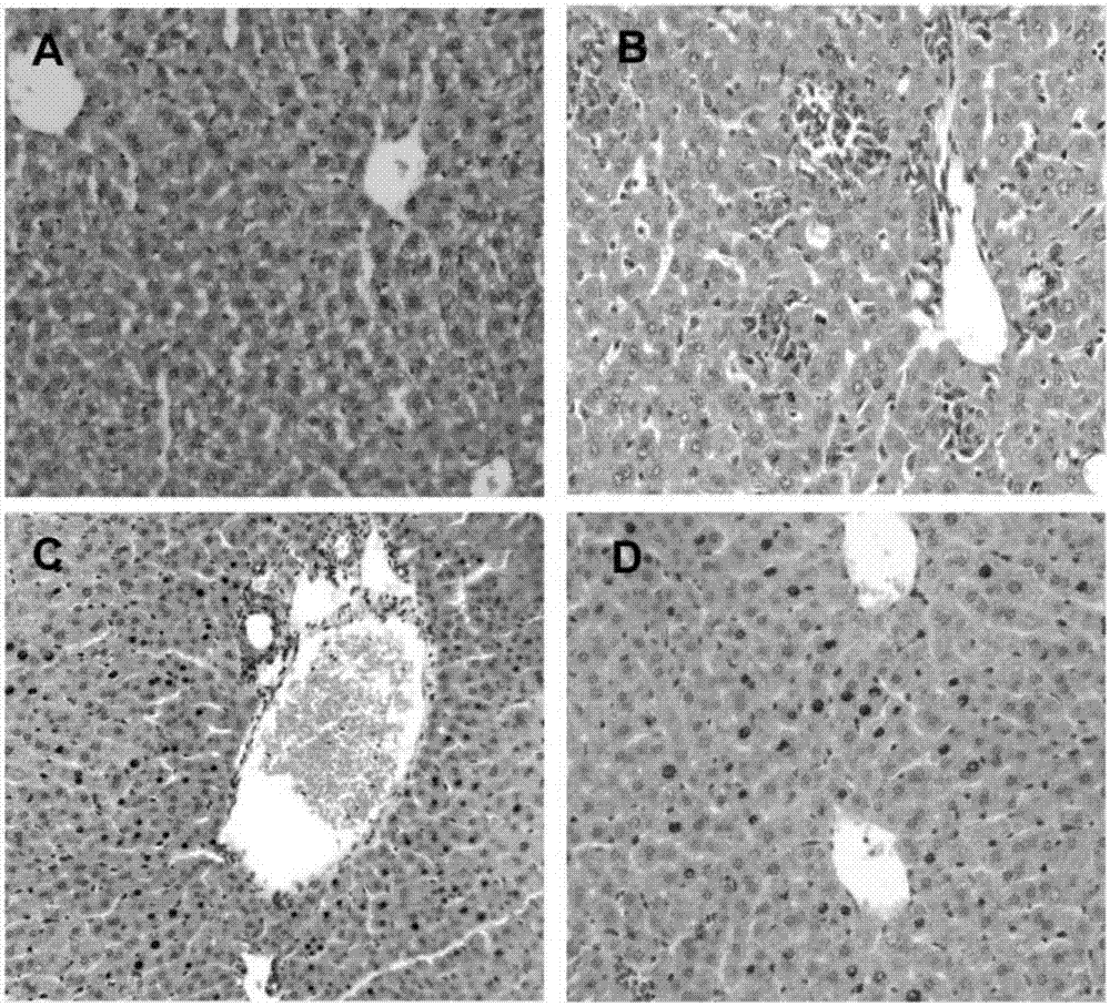 Application of alantolactone in preparing medicine for preventing liver injury