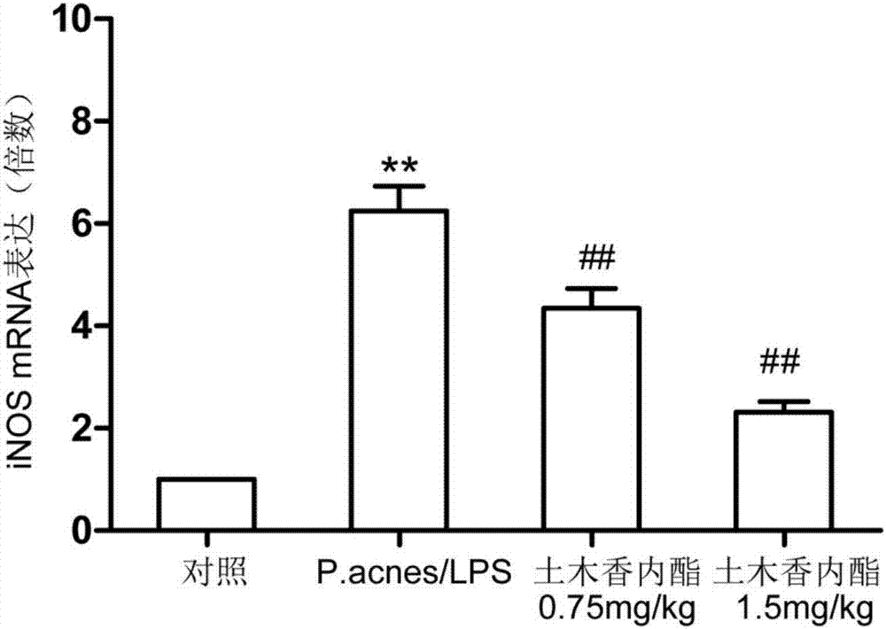 Application of alantolactone in preparing medicine for preventing liver injury