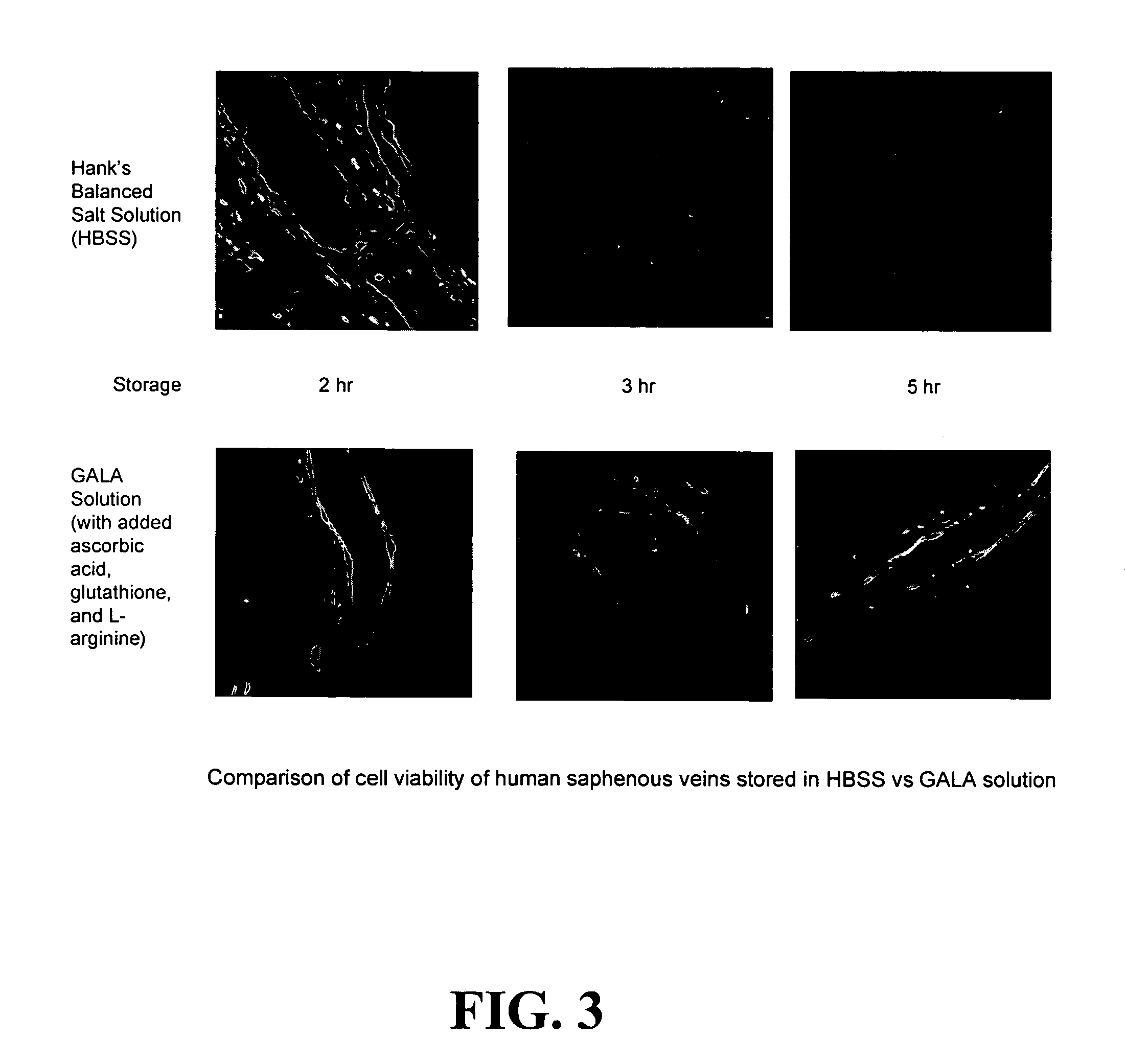 Composition and methods for tissue preservation