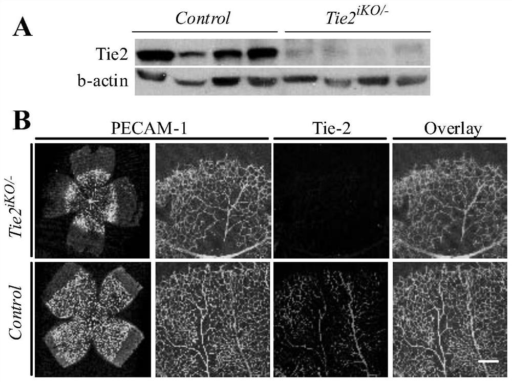 Protective effect and application of tie2 on venous vessels in retina and other tissues