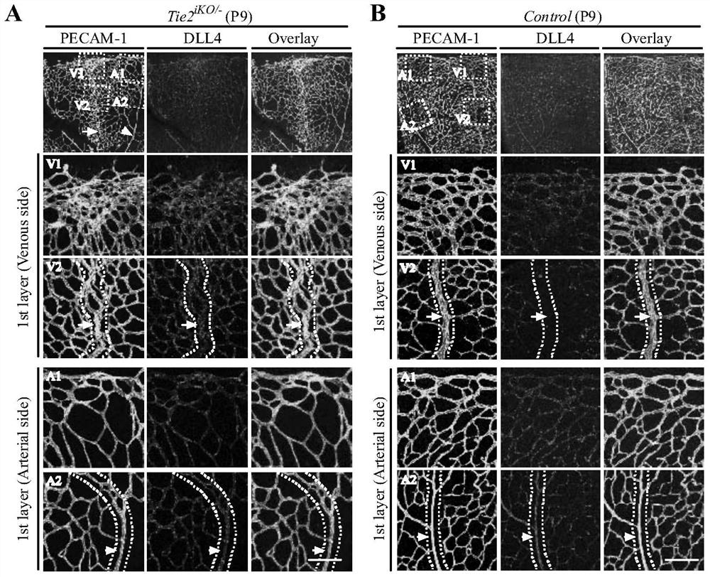 Protective effect and application of tie2 on venous vessels in retina and other tissues