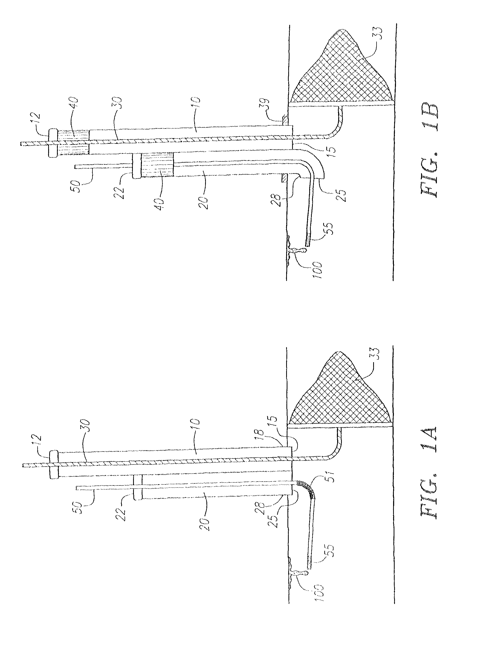 Direct access atherectomy devices and methods of use