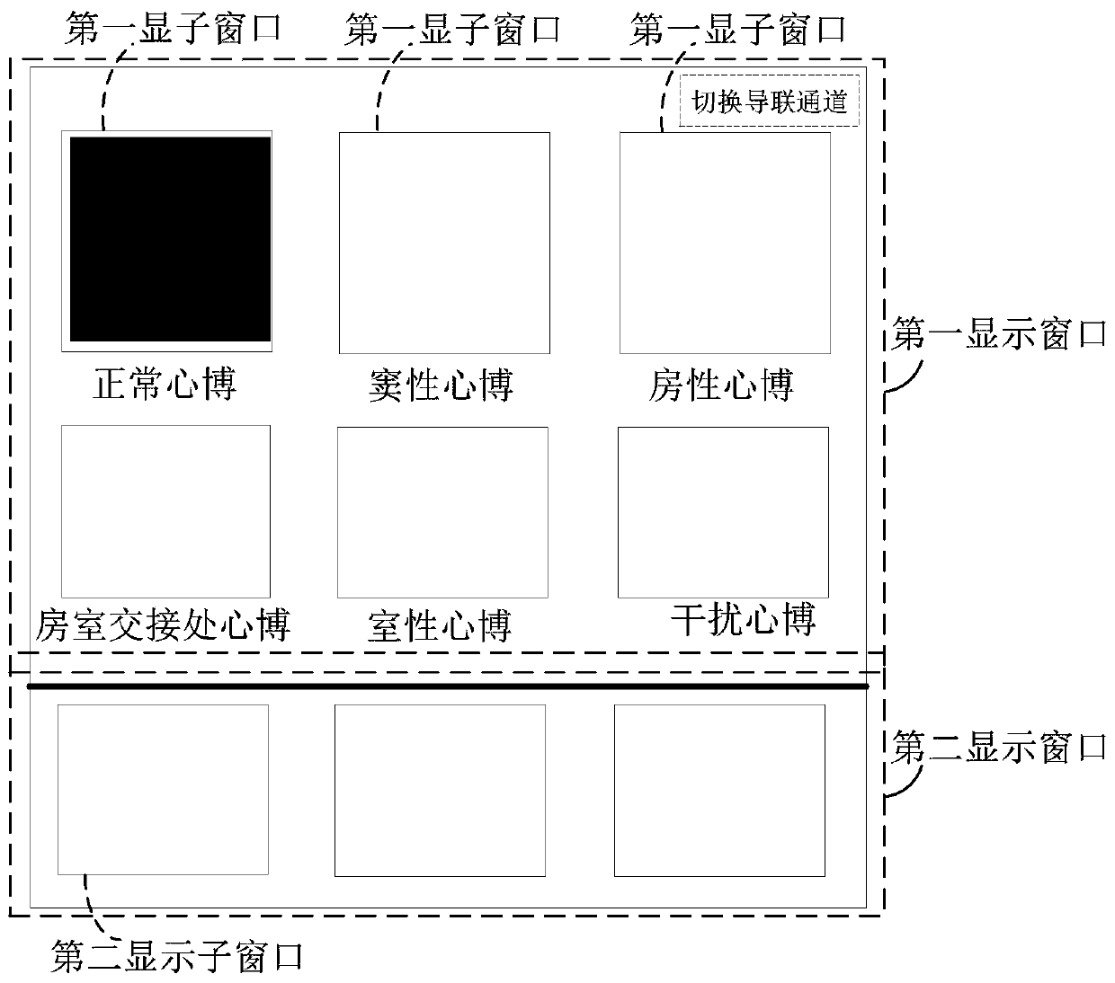 ECG waveform editing and displaying method and device and computer device