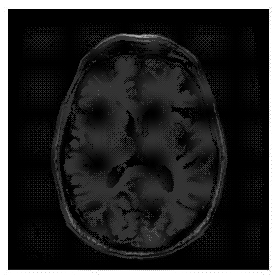 A Multiple Sclerosis Lesion Region Segmentation Method