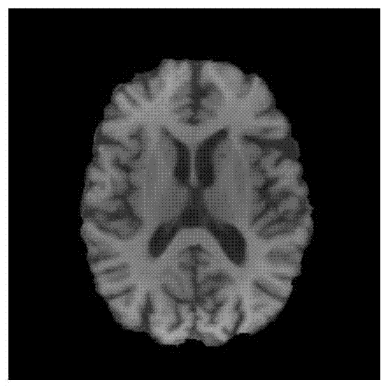 A Multiple Sclerosis Lesion Region Segmentation Method