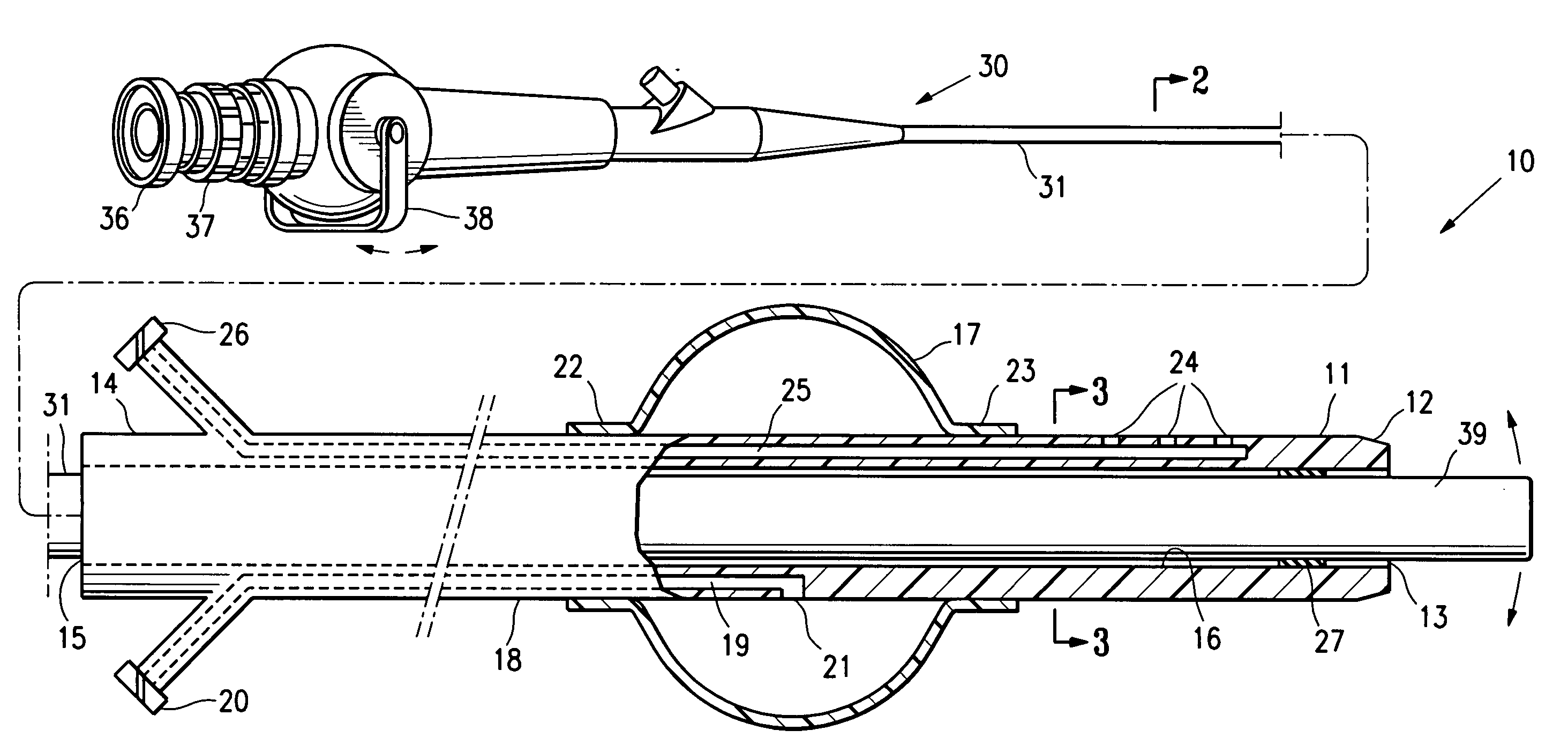 Endoscopic delivery of medical devices