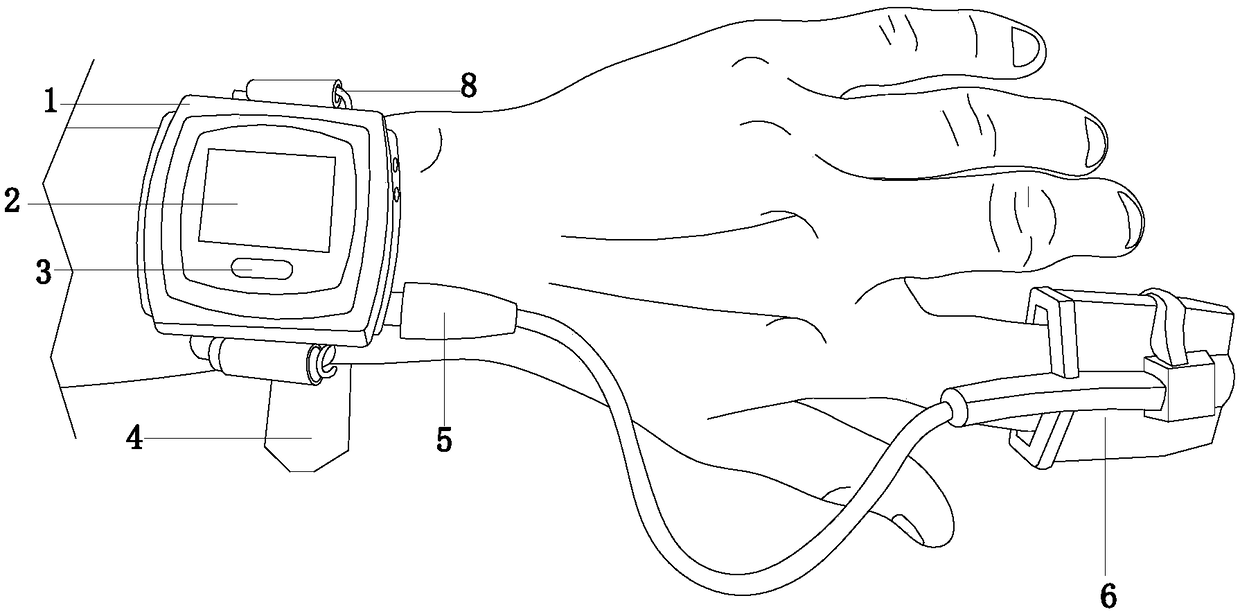 HBC-based epileptic seizure prevention wearable medical equipment