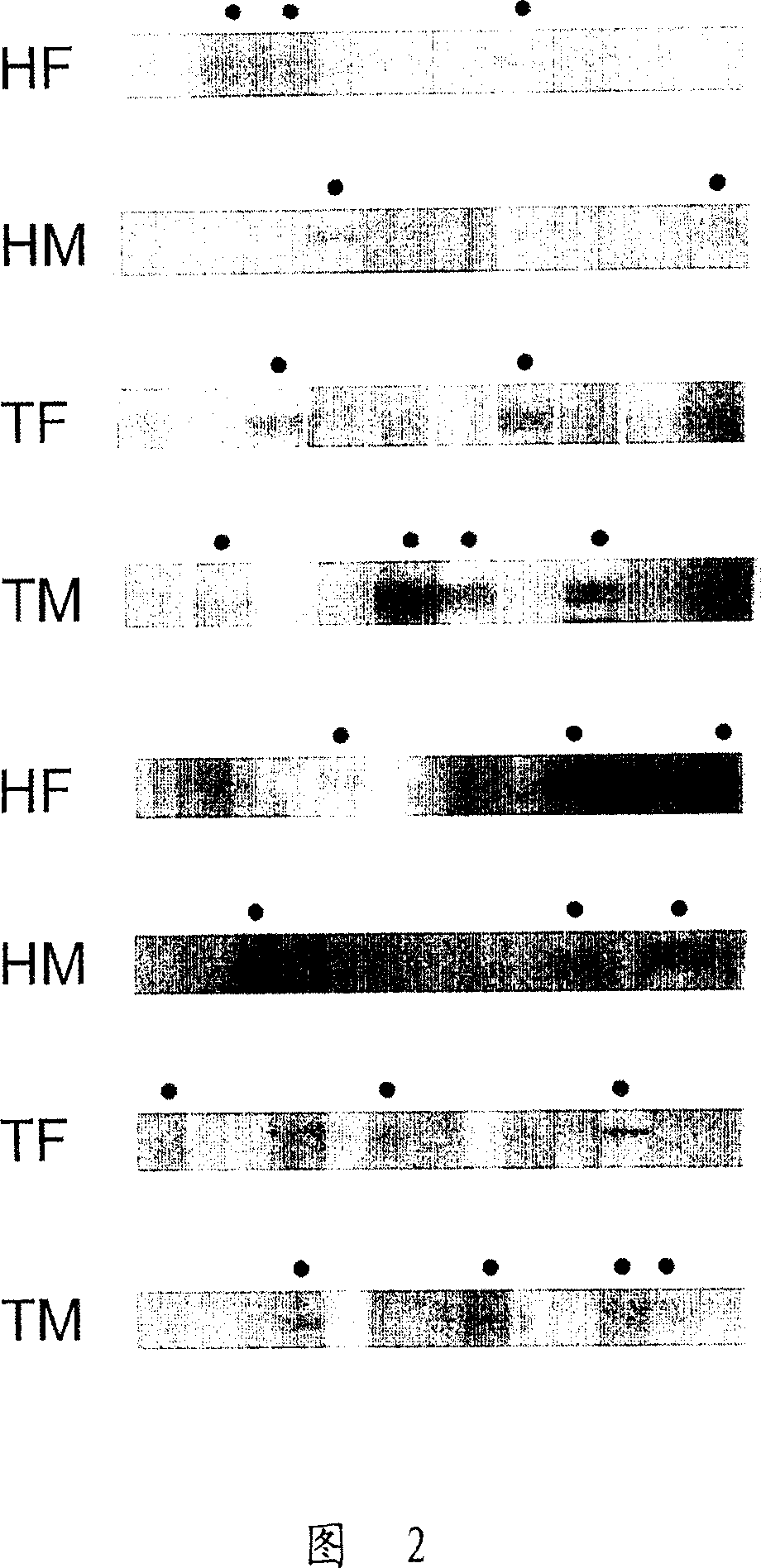 Method of diagnosing myasthenia gravis and kits therefor