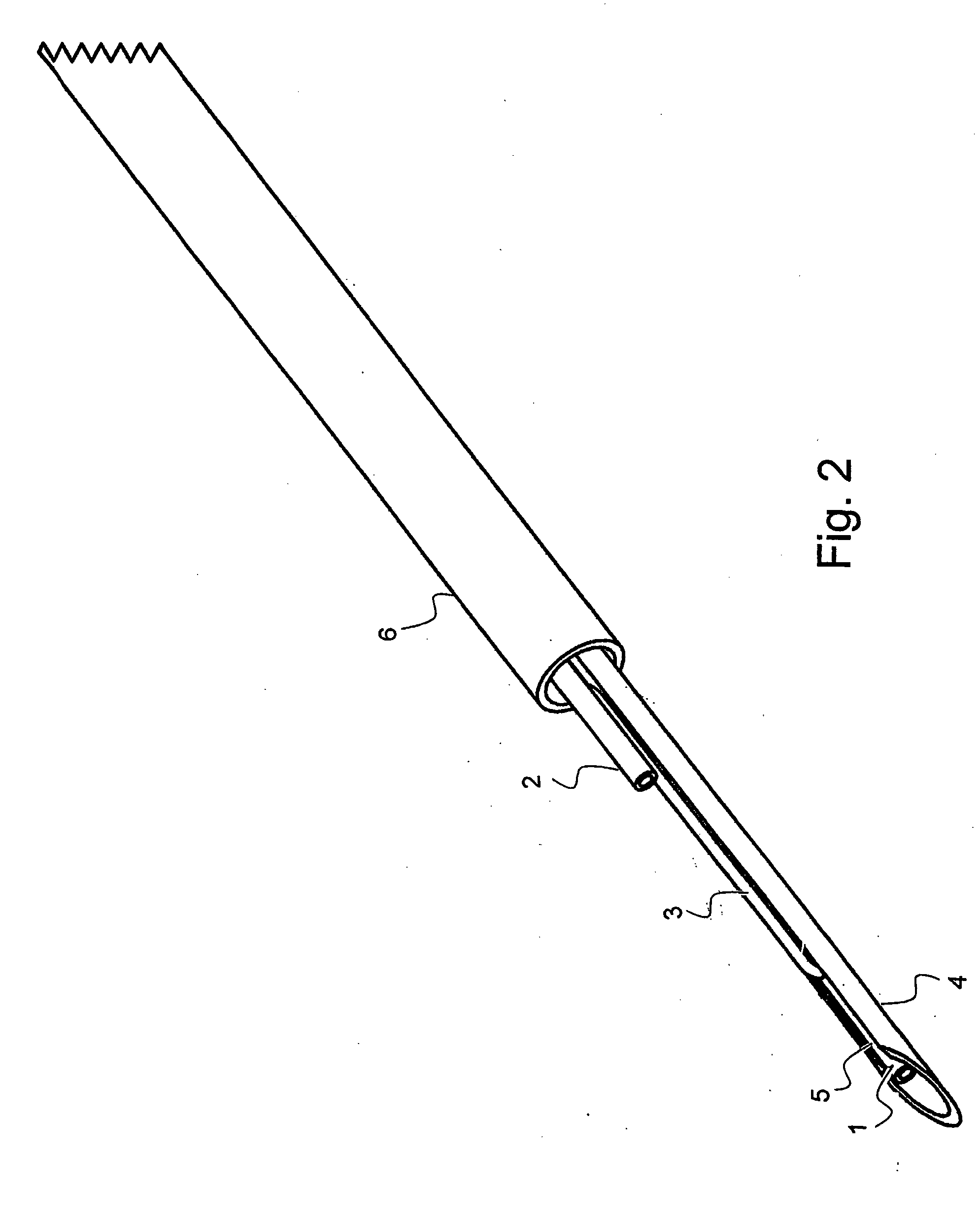 Article, system, and method for securing medical device to tissue or organ