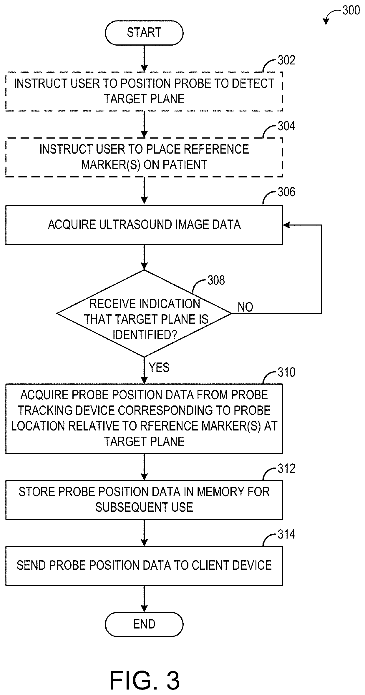 System and methods for at-home ultrasound imaging