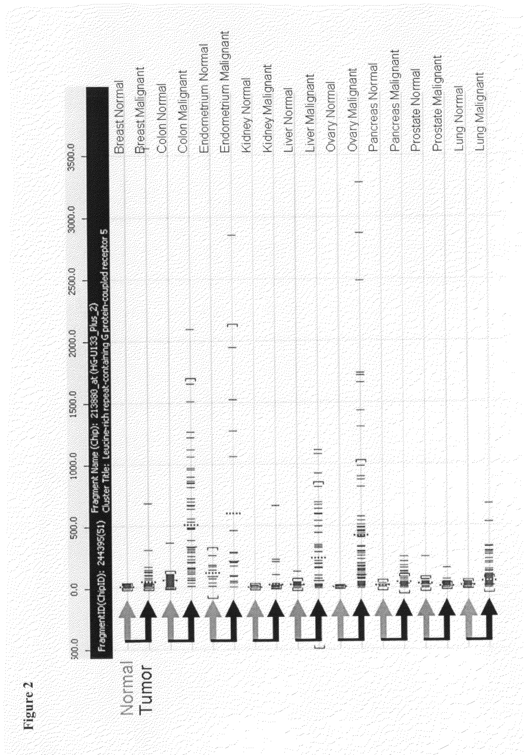 Compositions and Methods for Treating and Diagnosing Cancer