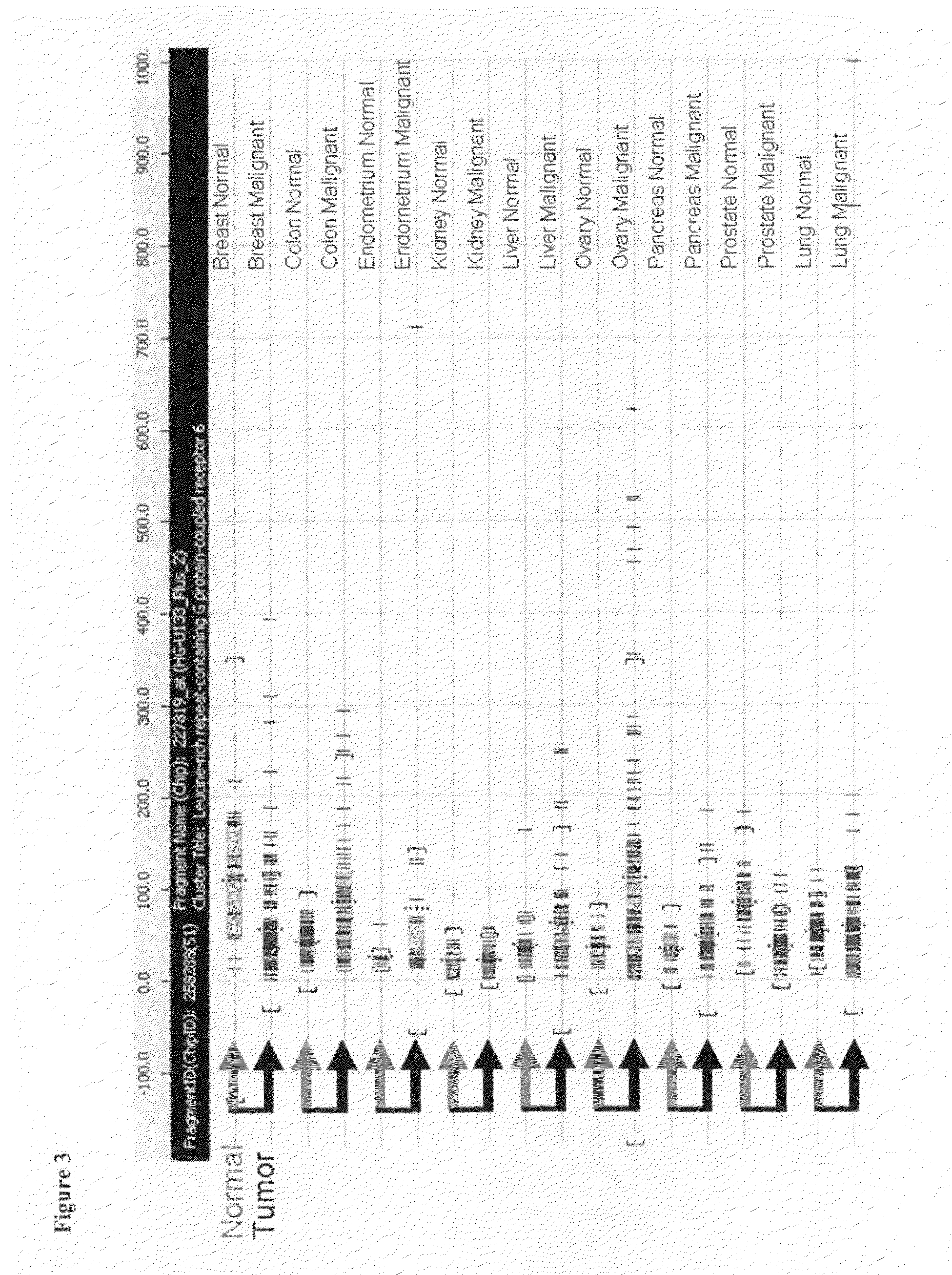 Compositions and Methods for Treating and Diagnosing Cancer