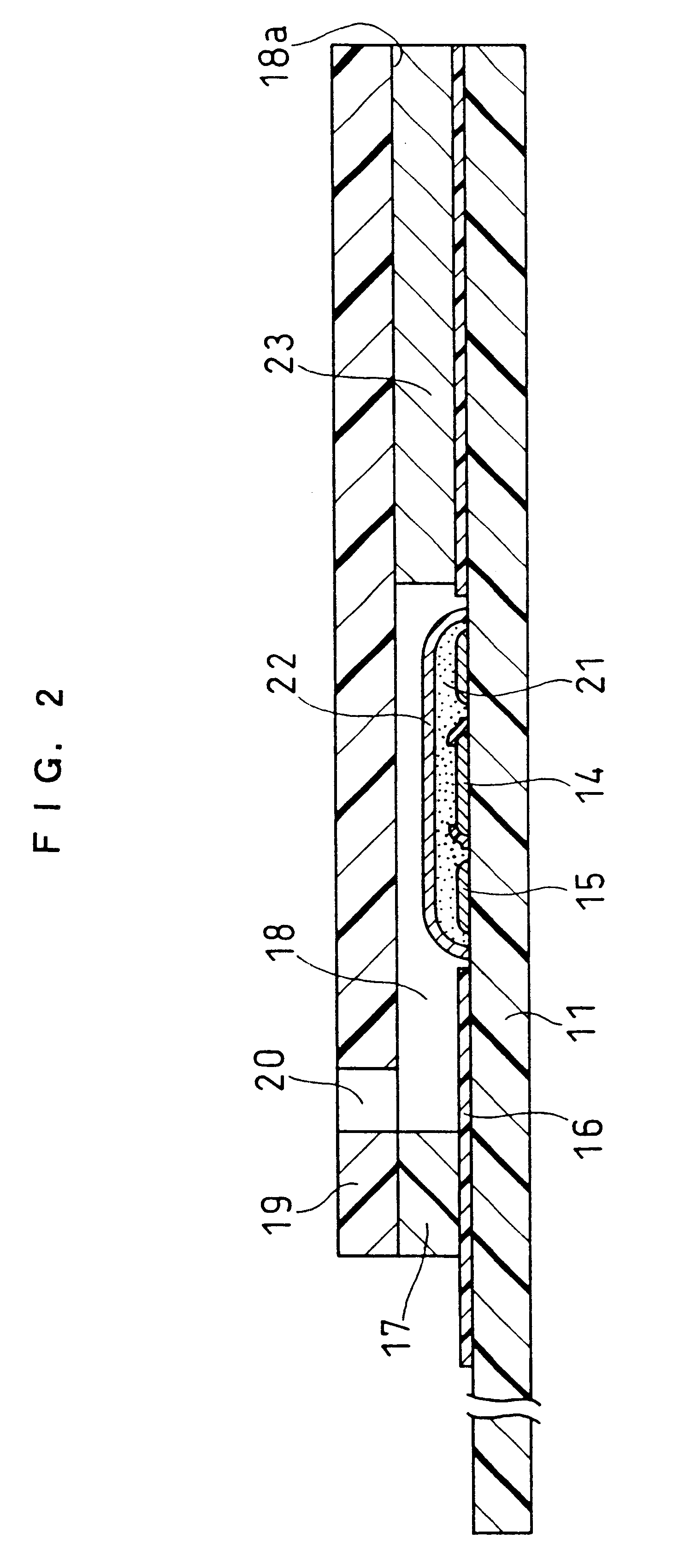 Cholesterol sensor and method of determining cholesterol