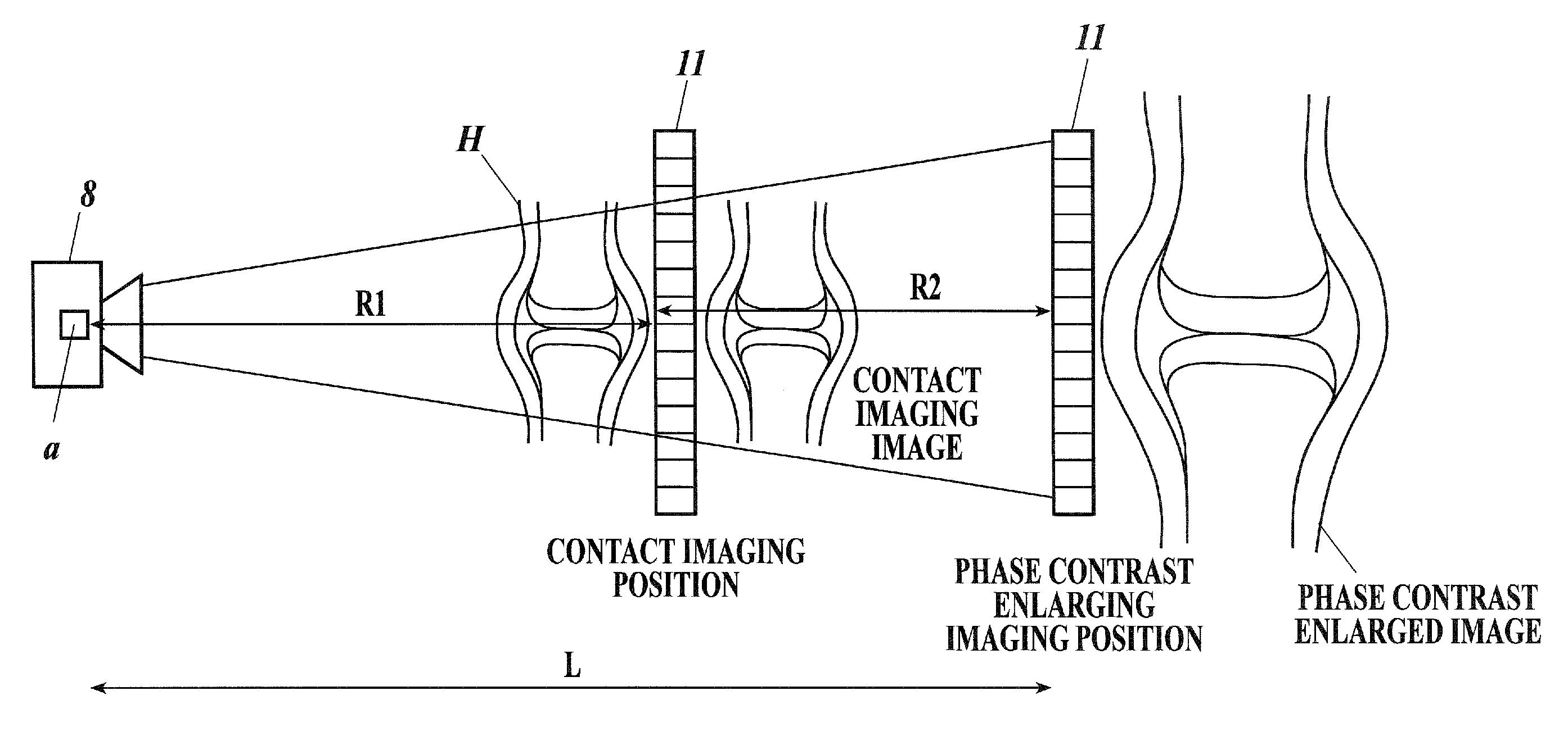 X-ray image analyzing system and program