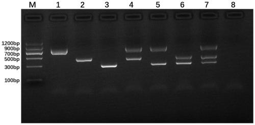 Primer and kit for simultaneously detecting two types of echinococcosis