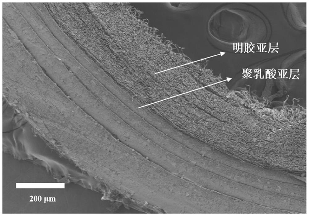 Tubular stent as well as preparation method and application thereof