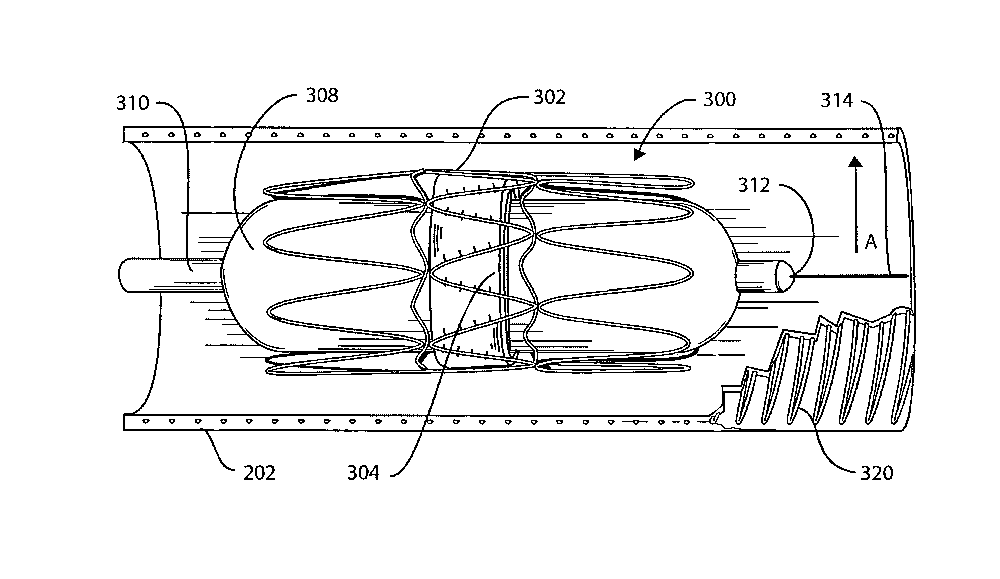 Reinforced Surgical Conduit for Implantation of a Stented Valve Therein