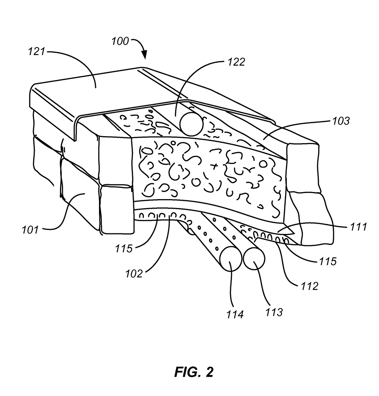 Composting system and method