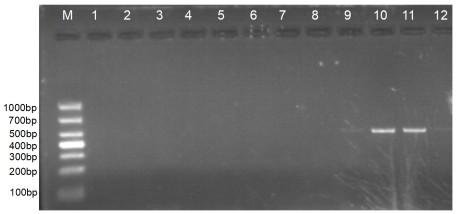 Ribosomal RNA sequence of pathogenic bacterium Septoria sp of oak abnormally withered disease and application thereof