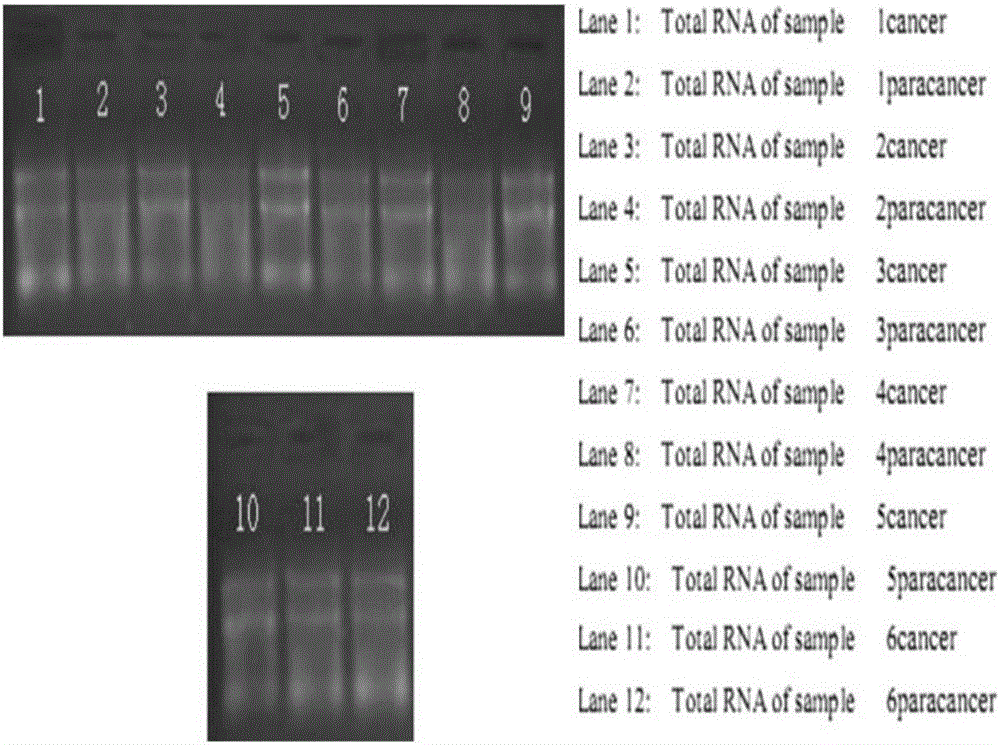 LncRNA molecule ENST00000438553 and application thereof in auxiliary diagnosis of nasopharyngeal carcinoma