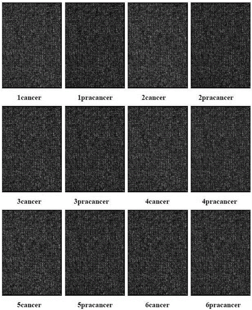 LncRNA molecule ENST00000438553 and application thereof in auxiliary diagnosis of nasopharyngeal carcinoma