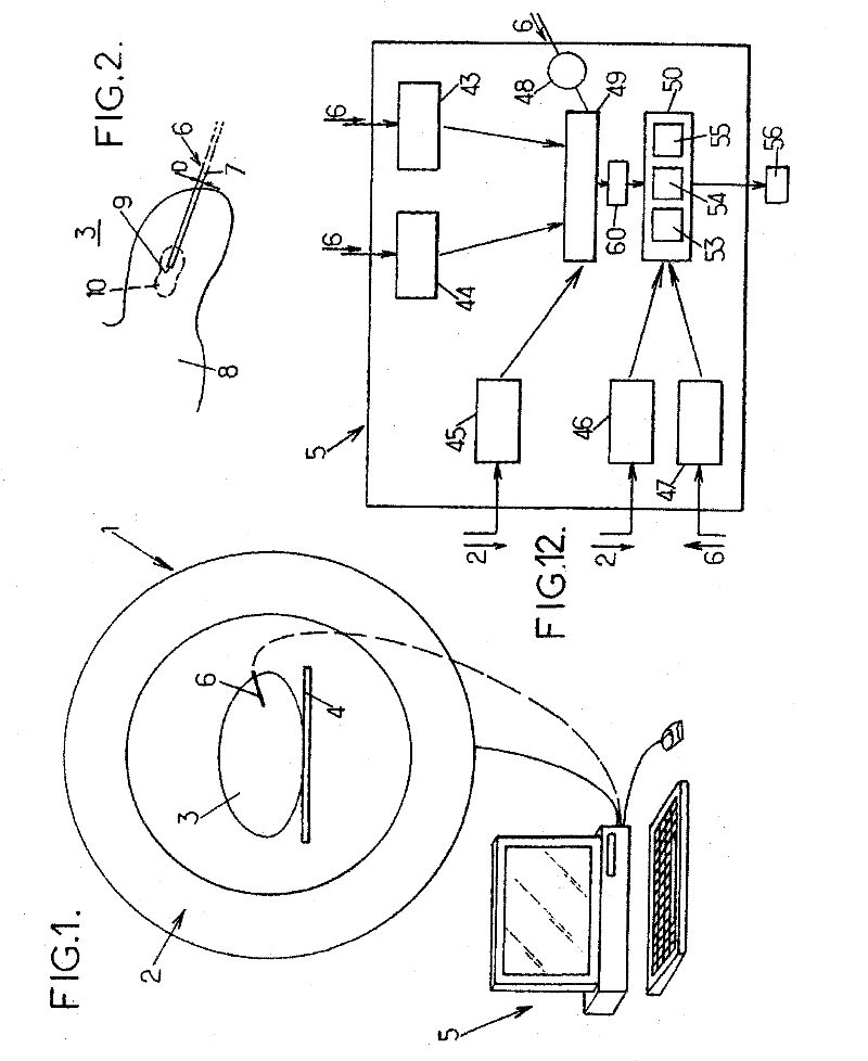 A medical system comprising a percutaneous probe