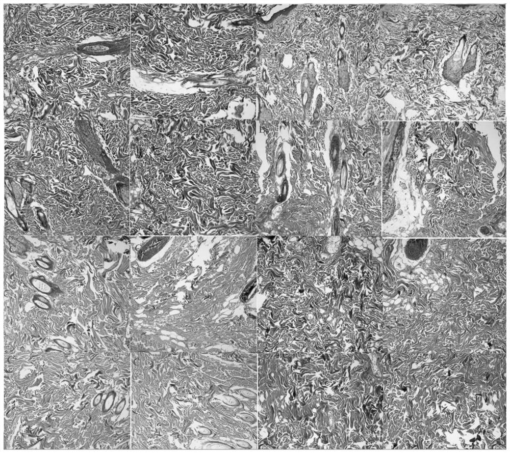 Traditional Chinese medicine plaster for promoting wound healing and reducing scar formation and preparation method thereof