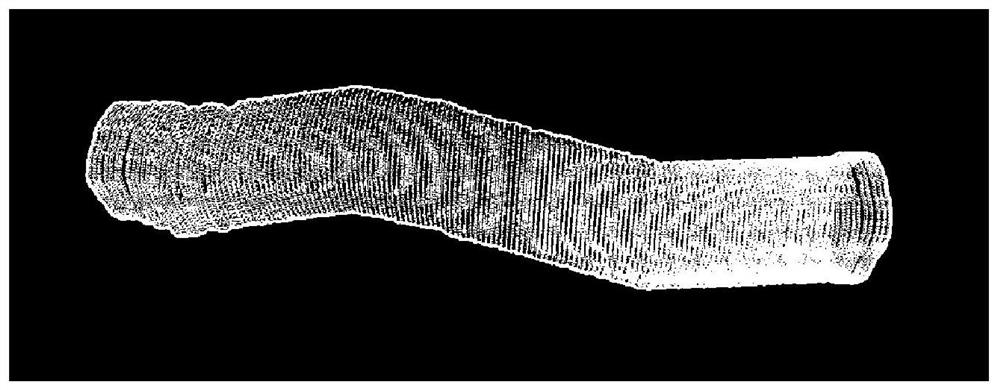 Ultrasonic image three-dimensional reconstruction method for intelligent medical auxiliary diagnosis