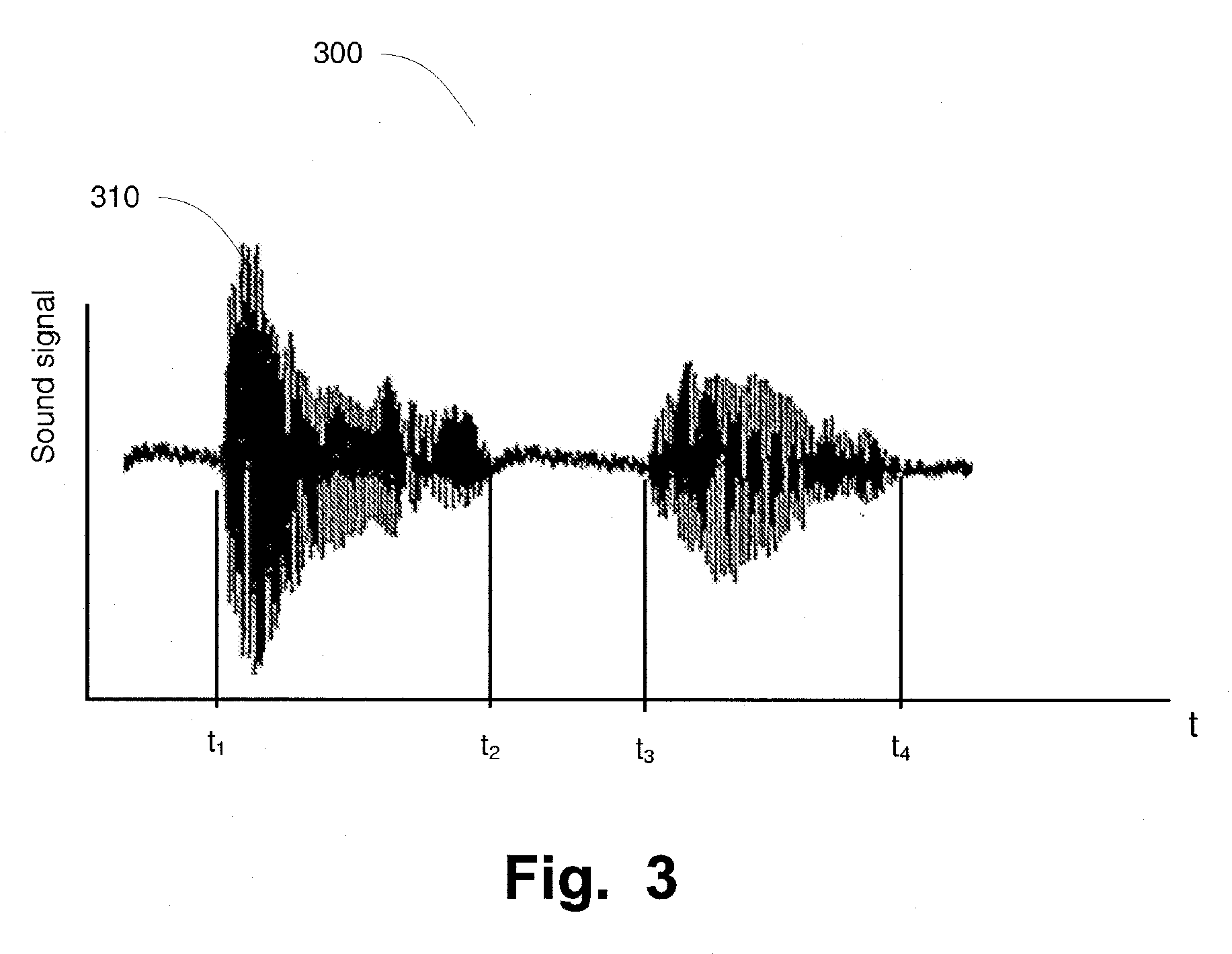 System and methods for assessment of the aging brain and its brain disease induced brain dysfunctions by speech analysis