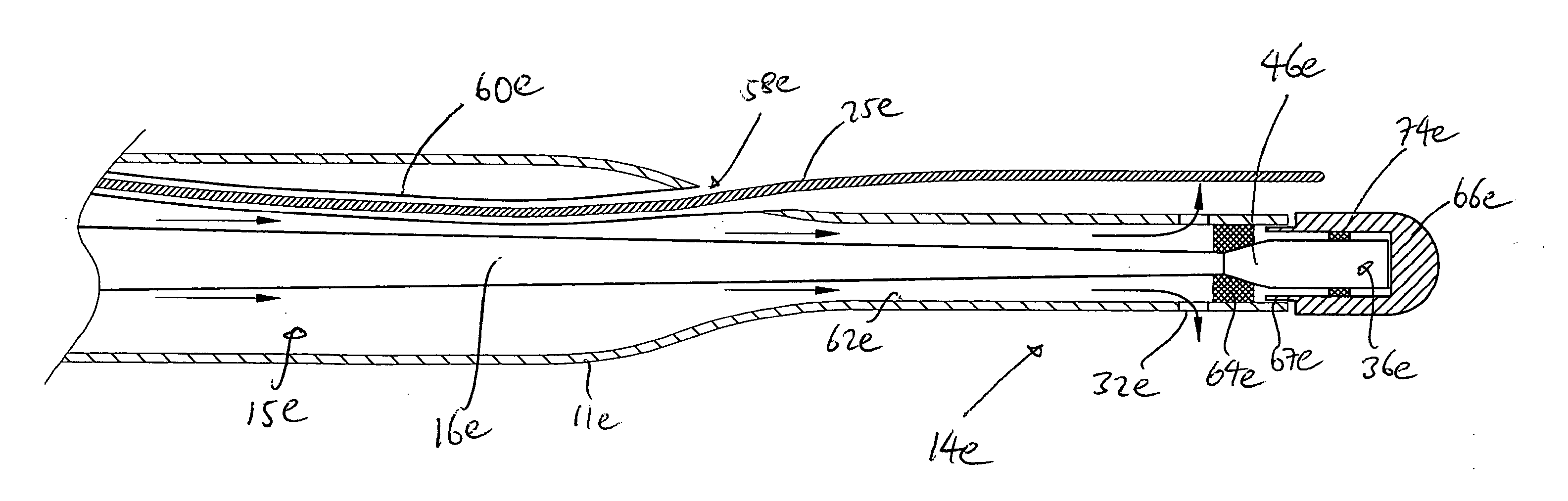 Ultrasound Catheter Having Protective Feature Against Breakage