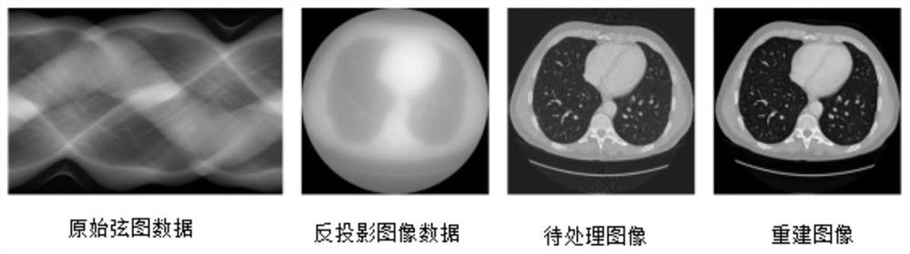 A CT image reconstruction method based on convolutional neural network