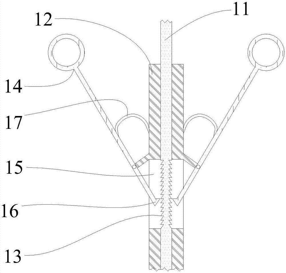 Two-section rod for removing object from abdominal cavity