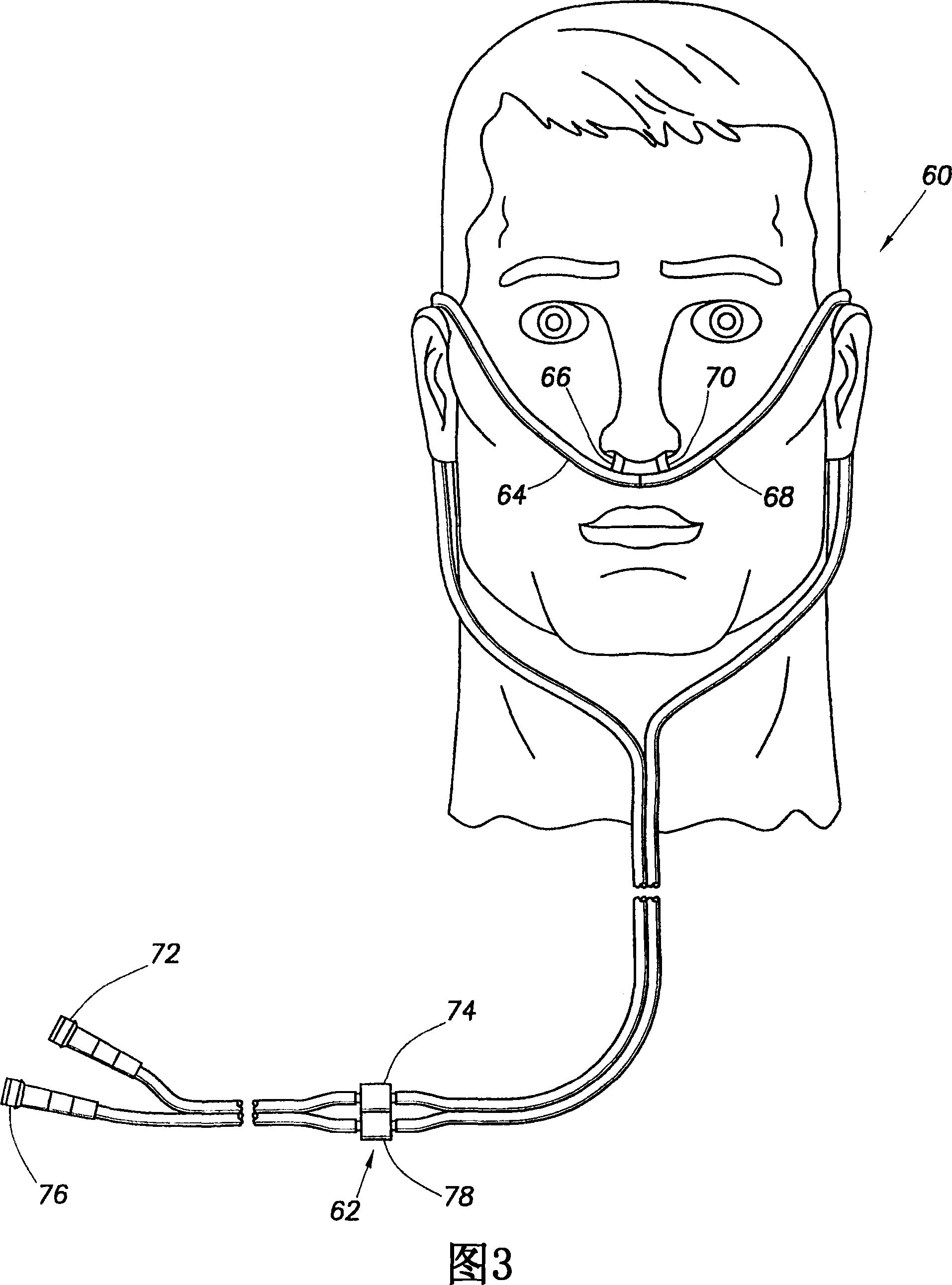 Nasal cannula