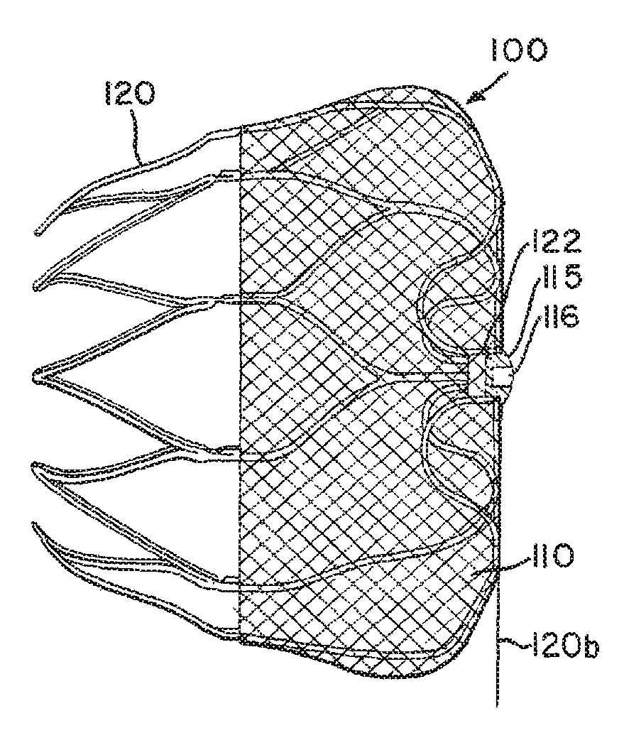 Atrial appendage blood filtration systems