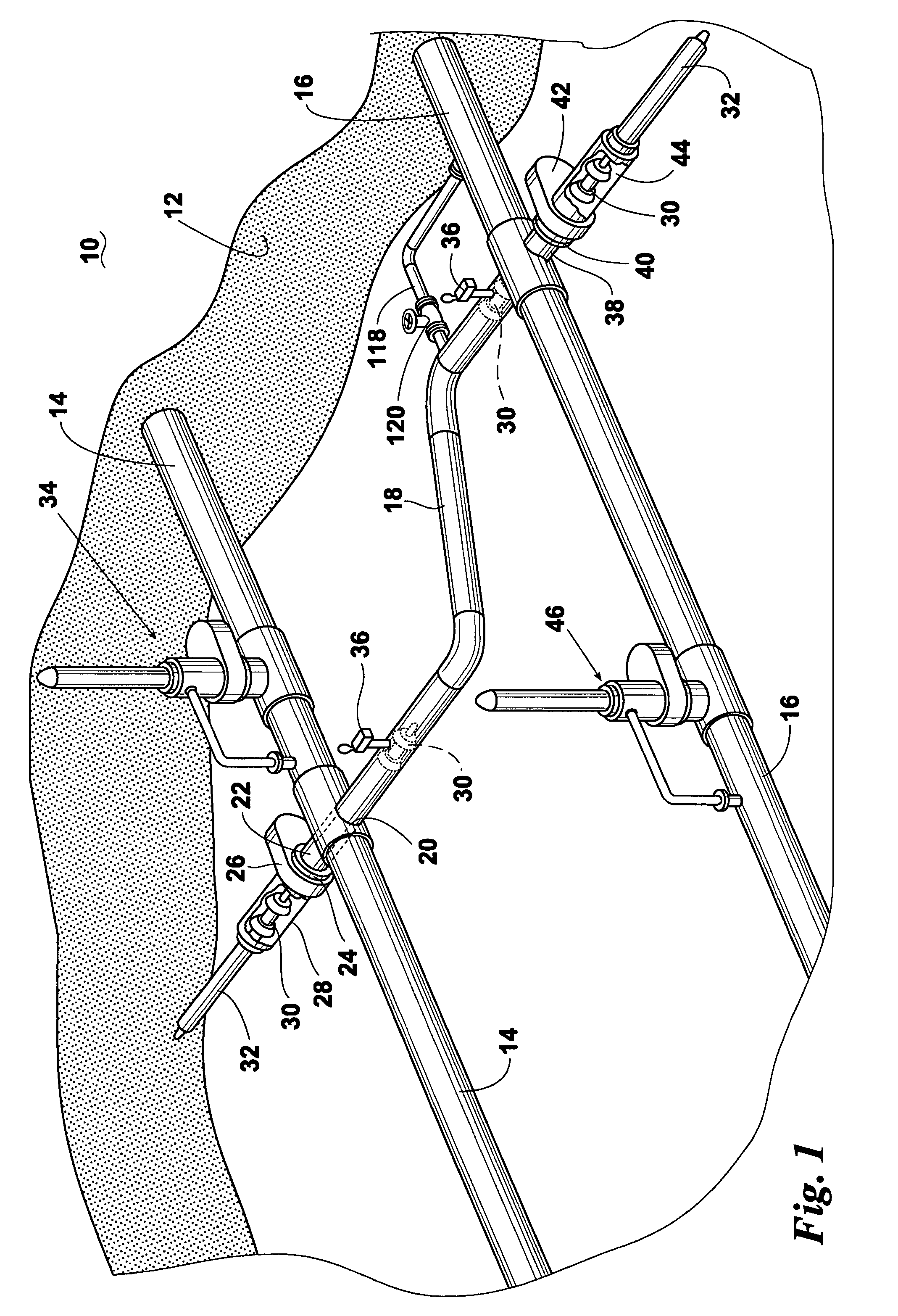 Cross-line plugging system