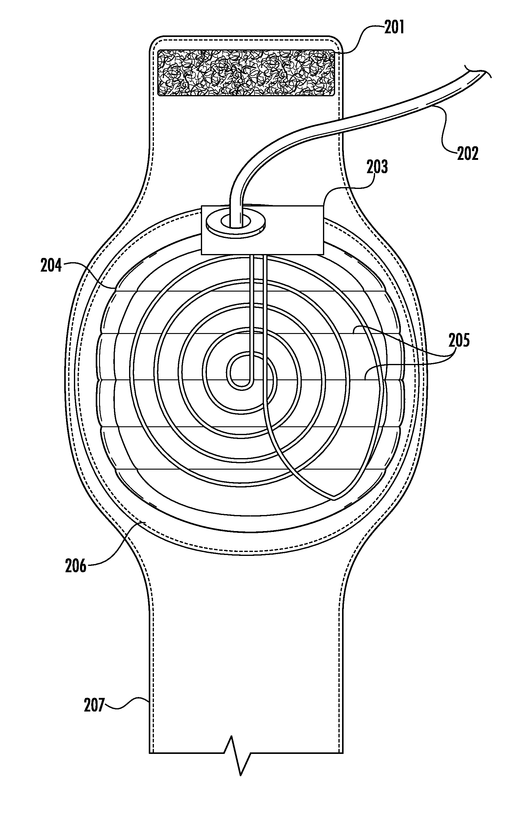 Universal Diathermy Heat Applicator