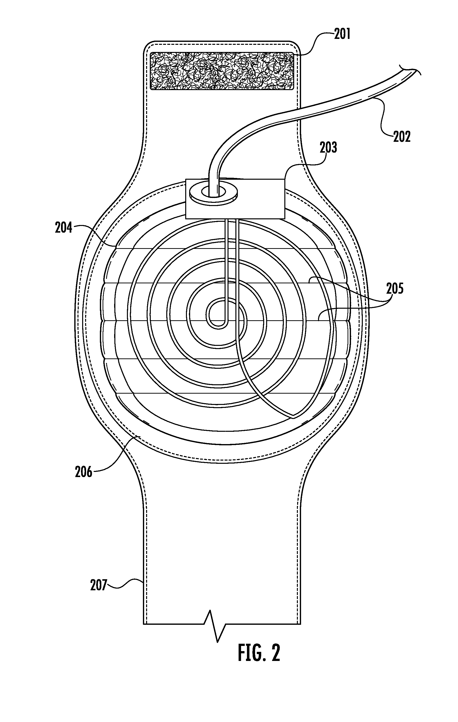 Universal Diathermy Heat Applicator