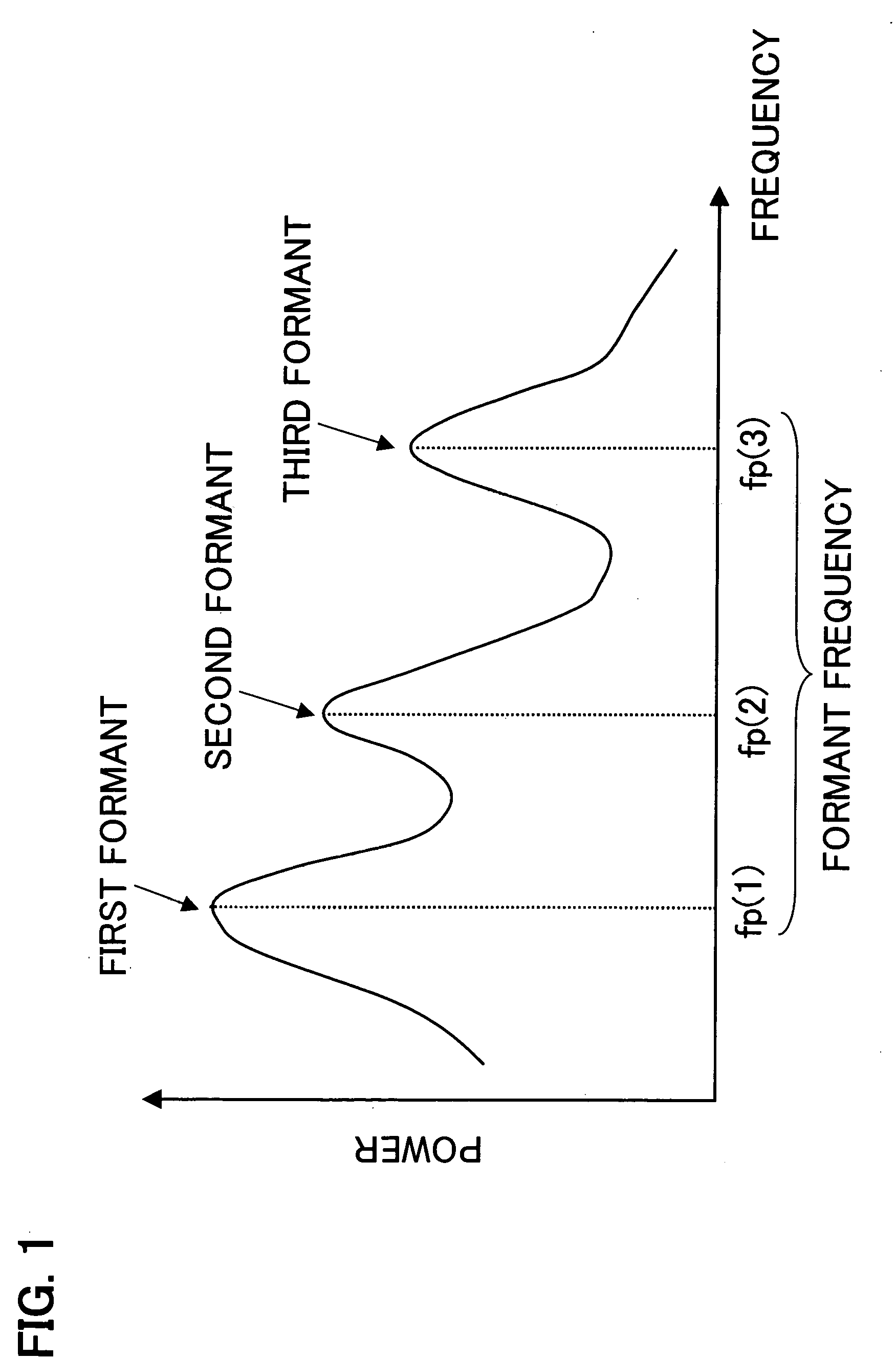 Voice enhancement device