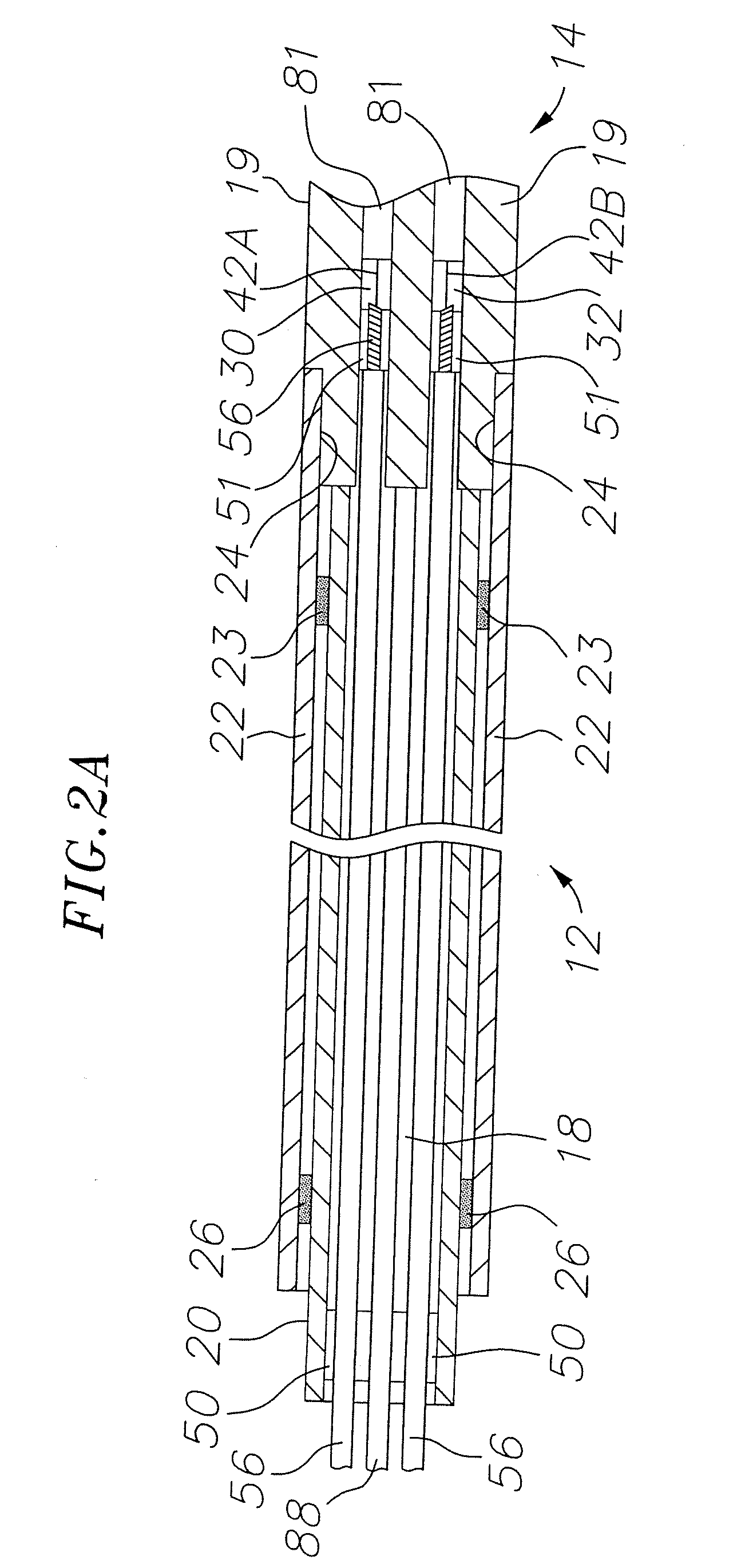 Catheter with single axial sensors